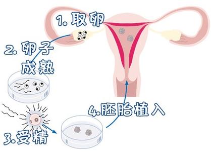 代生选性别包男孩